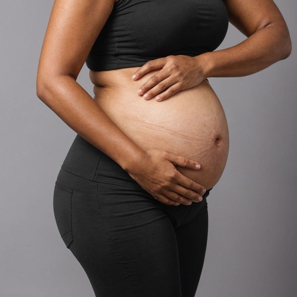 Quelles sont les meilleures pratiques pour réduire les risques de vergetures pendant la grossesse?